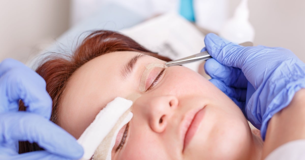 femme en train de subir une chirurgie des paupieres