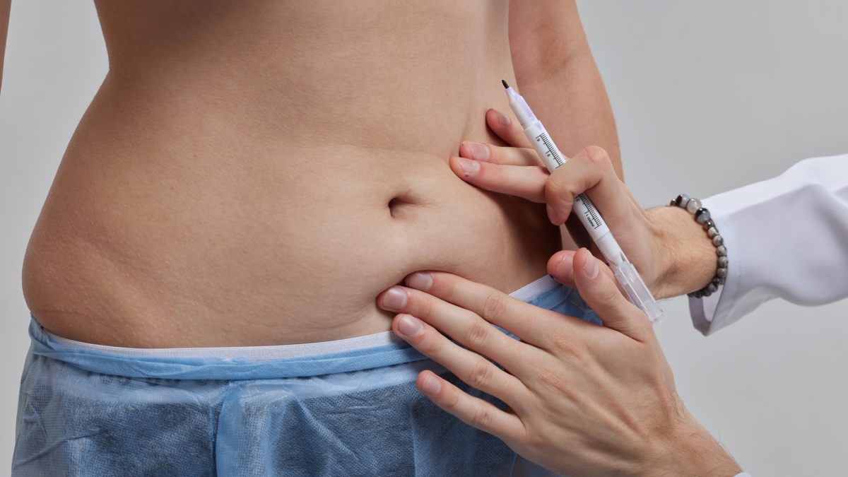 Examen avant une abdominoplastie.