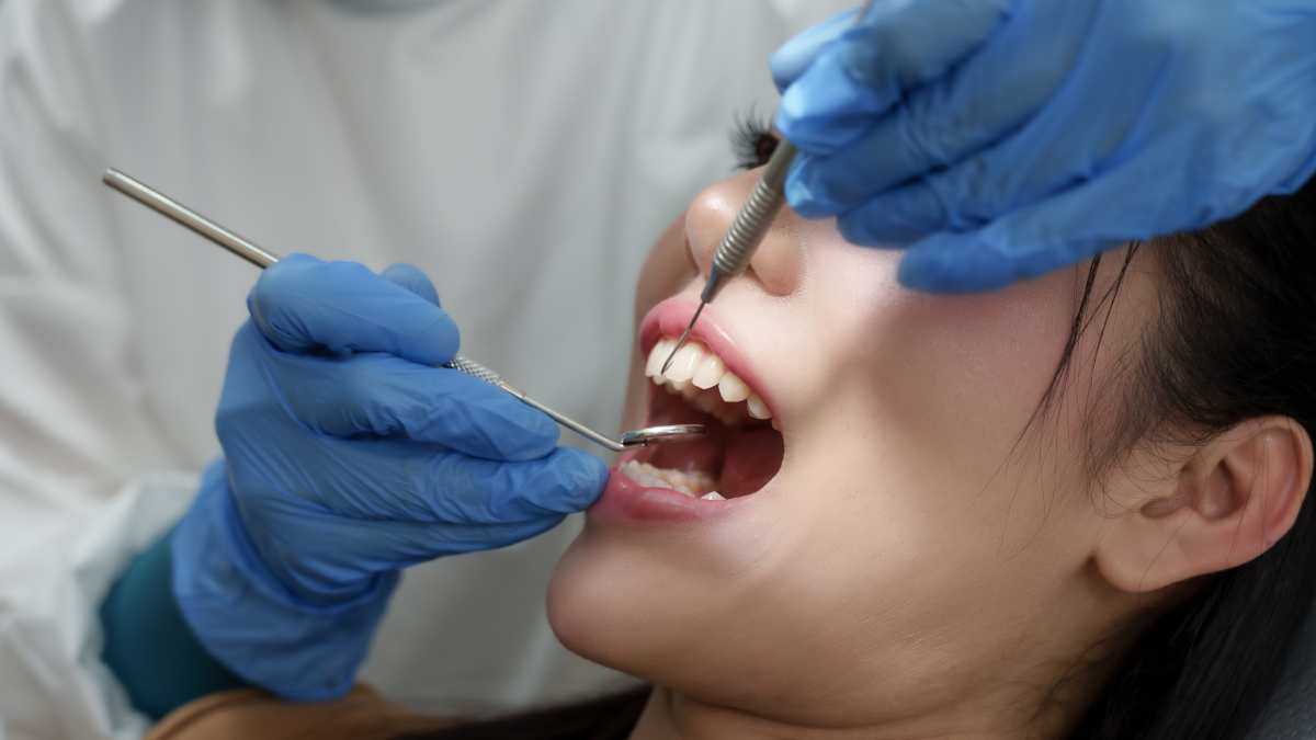 Patiente qui commence un détartrage chez le dentiste.