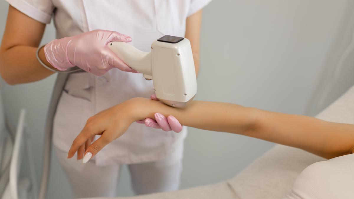 Epilation au laser sur le bras d'une patiente.