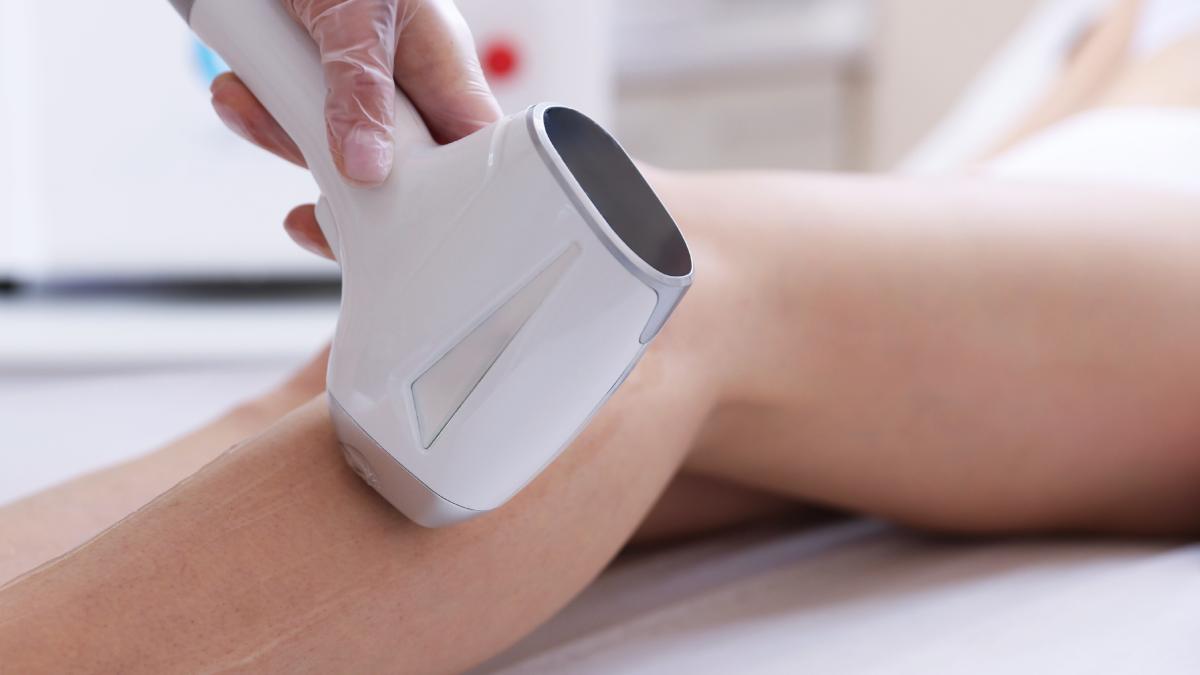 Epilation au laser sur la jambe d'une jeune femme.