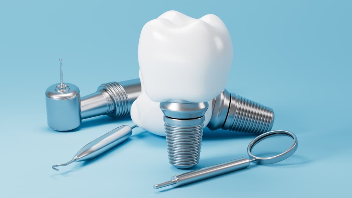 Implant dentaire avec plusieurs instruments de dentitste.