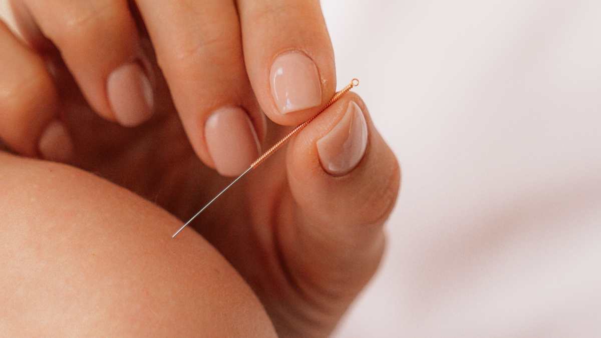 Une séance d'acupuncture sur l'épaule d'un patient.